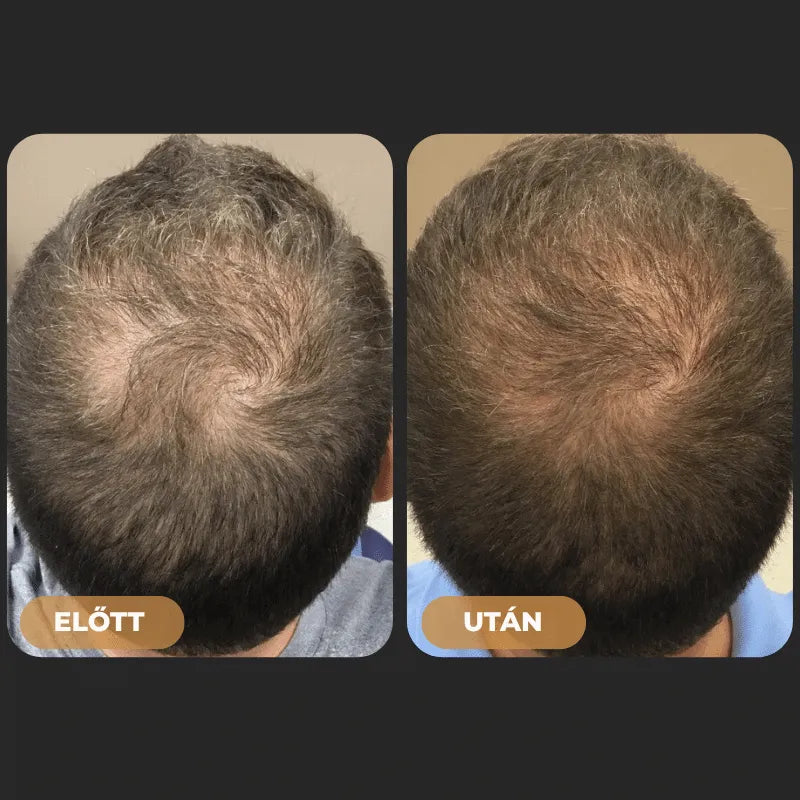 Szampon rewitalizujący włosy Orylo™ RootBoost