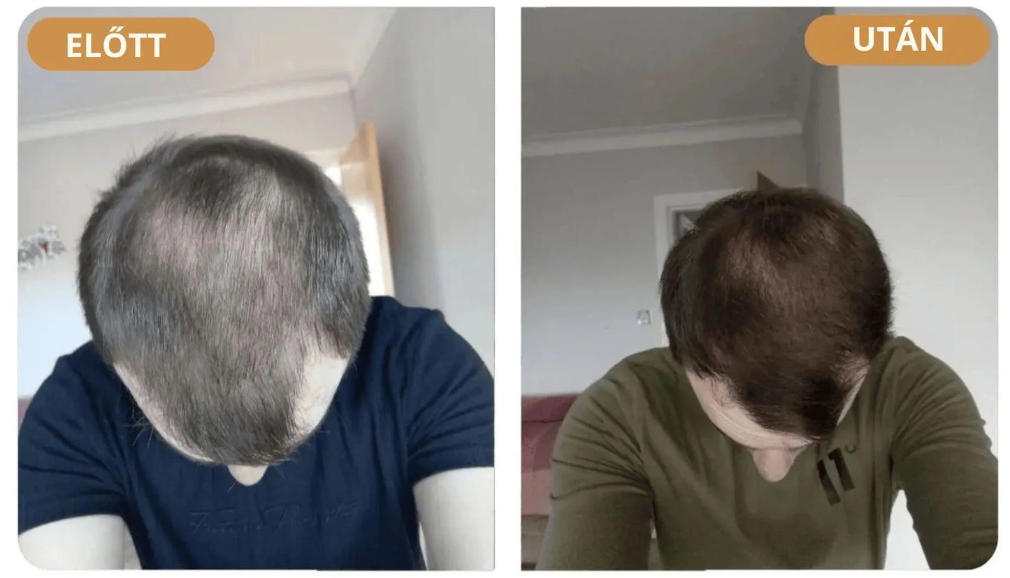 Szampon rewitalizujący włosy Orylo™ RootBoost