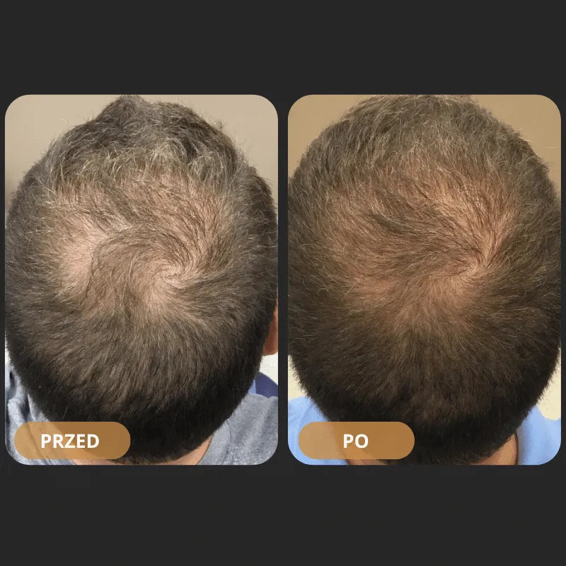 Szampon rewitalizujący włosy Orylo™ RootBoost