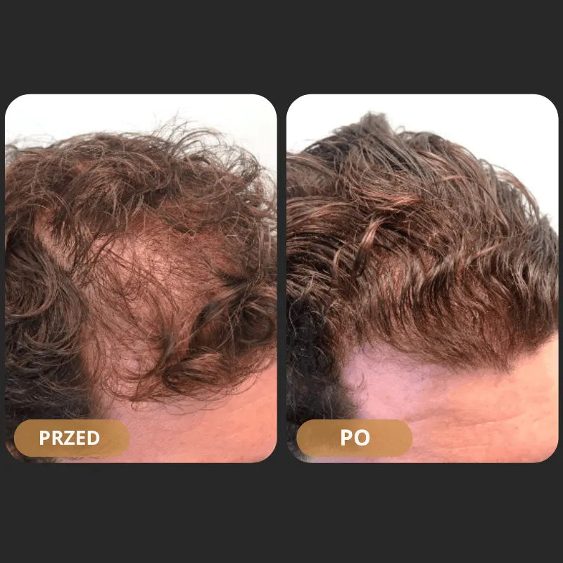 Szampon rewitalizujący włosy Orylo™ RootBoost
