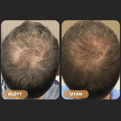 Szampon rewitalizujący włosy Orylo™ RootBoost