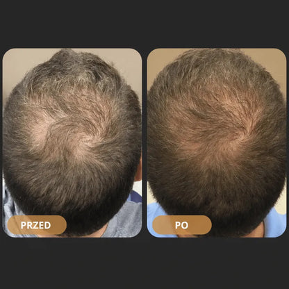 Szampon rewitalizujący włosy Orylo™ RootBoost